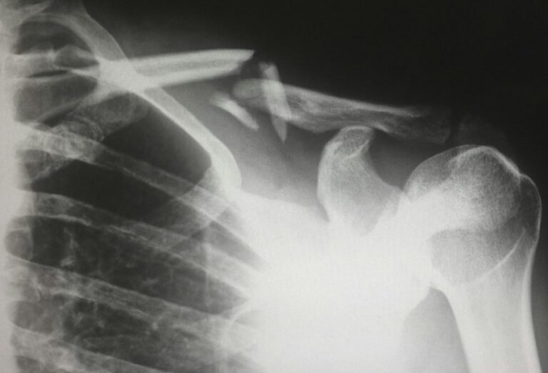 sazs3-home-health-services-others-card-radiology