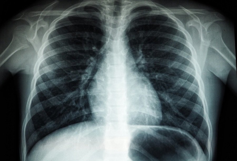 sazs3-radiology-card-1