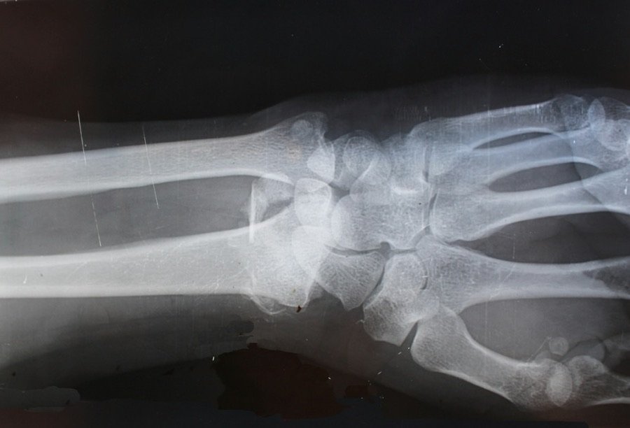 sazs3-radiology-card-3